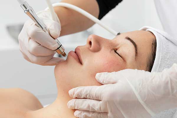 Hautverjüngung mit Diamant Mikrodermabrasion Anti-Aging Behandlungen im The Cream Kosmetikstudio