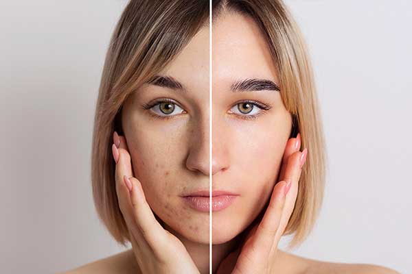 Effektive Gesichtsbehandlungen zur Hautverbesserung im The Cream Kosmetikstudio für Böblingen Effektive Gesichtsbehandlungen zur Hautverbesserung im The Cream Kosmetikstudio für Böblingen